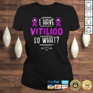 ClassicLadies Official Purple Awareness Ribbon I Have Vitiligo So WhaShirt