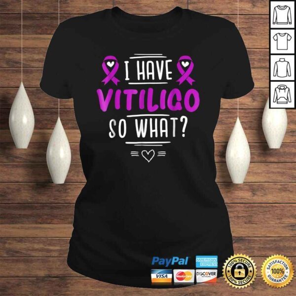 Official Purple Awareness Ribbon - I Have Vitiligo So WhaShirt - Image 3