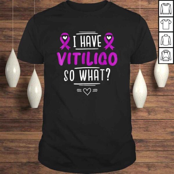 Official Purple Awareness Ribbon - I Have Vitiligo So WhaShirt