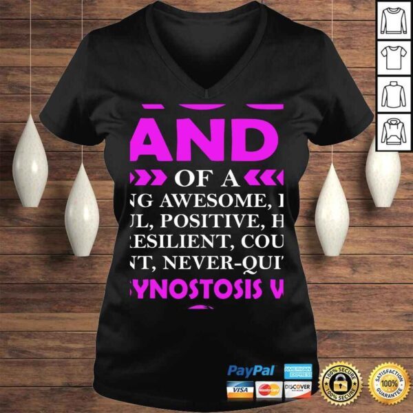 I'm proud grandma of CRANIOSYNOSTOSIS warrior Tee Shirt - Image 2