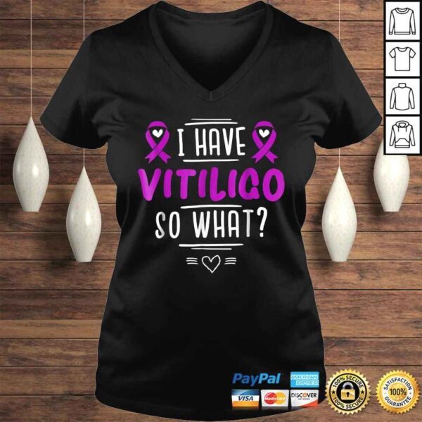 Official Purple Awareness Ribbon - I Have Vitiligo So WhaShirt - Image 2